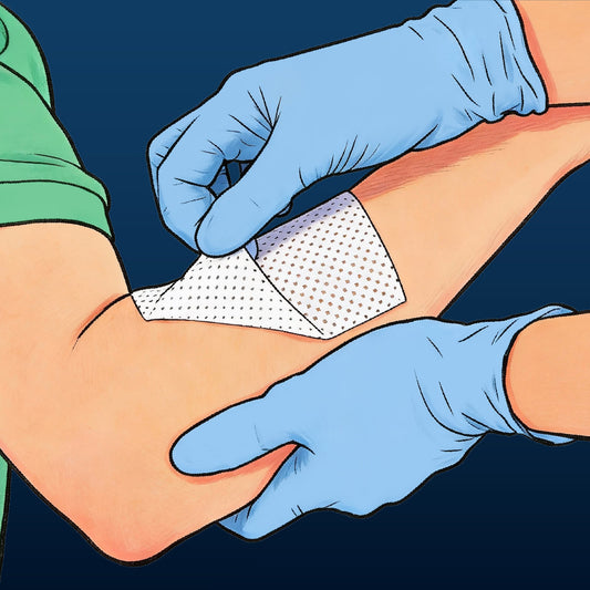 A solution to cost-effective wound management in the community