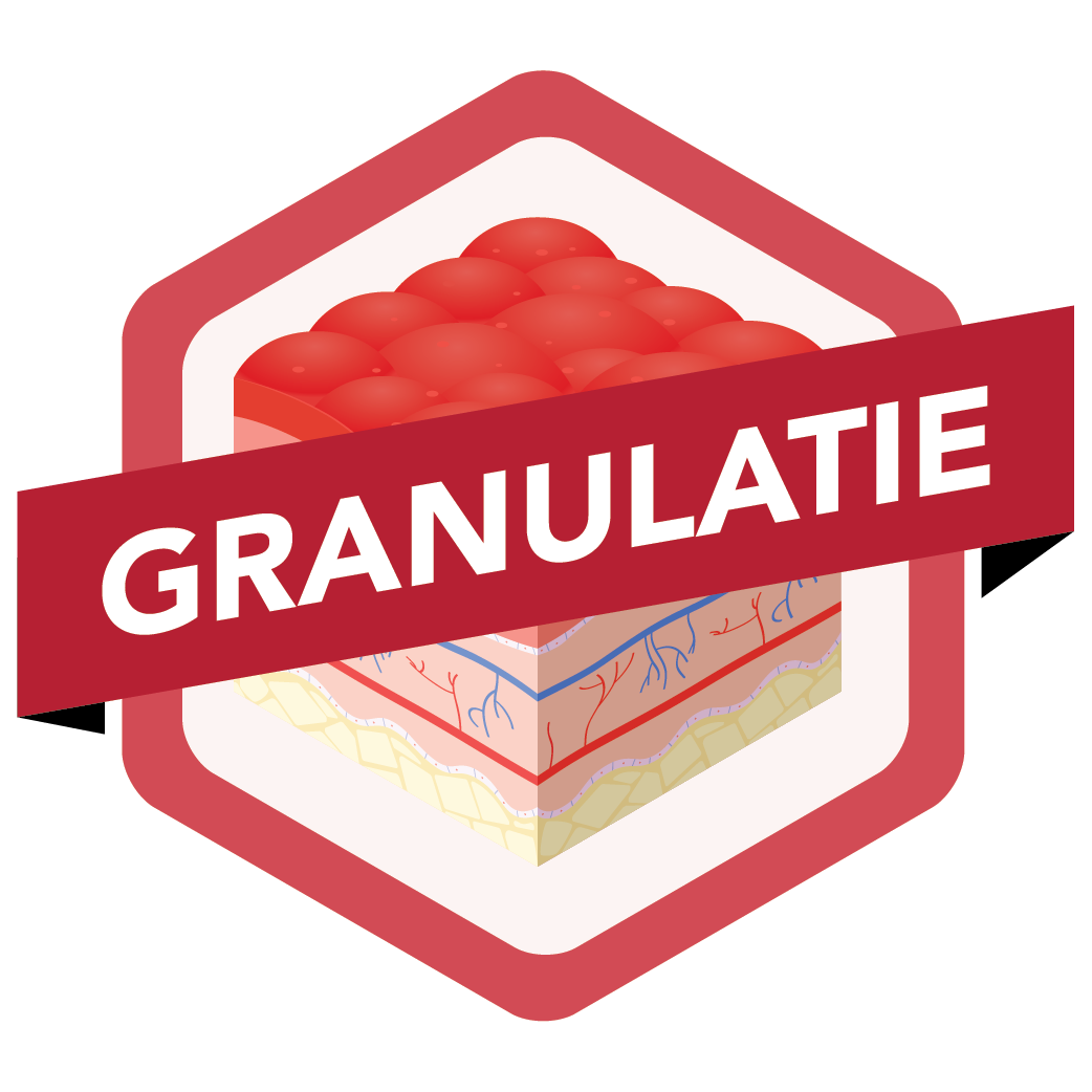 Granulating